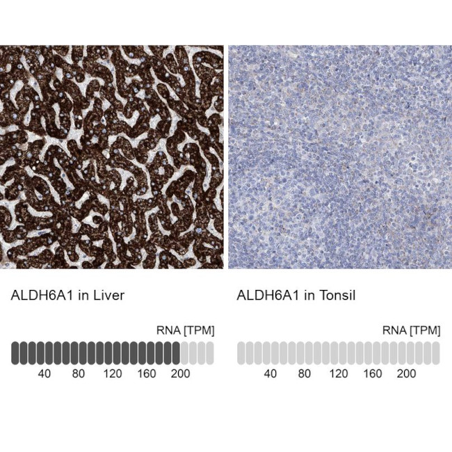 ALDH6A1 Antibody