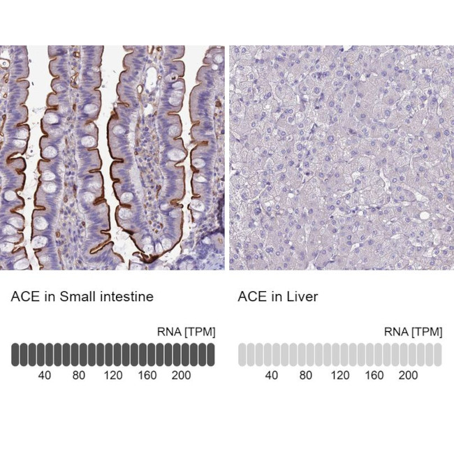 ACE Antibody