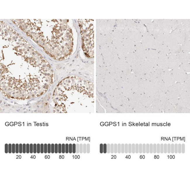 GGPS1 Antibody