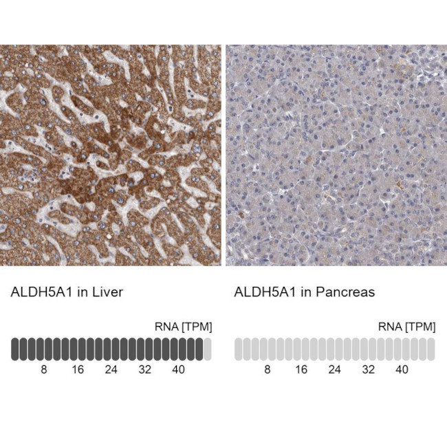 ALDH5A1 Antibody