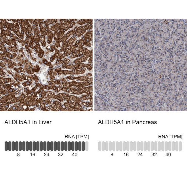 ALDH5A1 Antibody