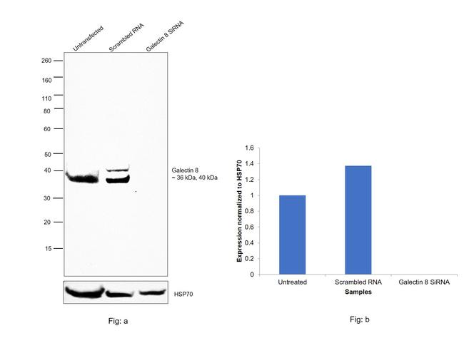 Galectin 8 Antibody in Western Blot (WB)