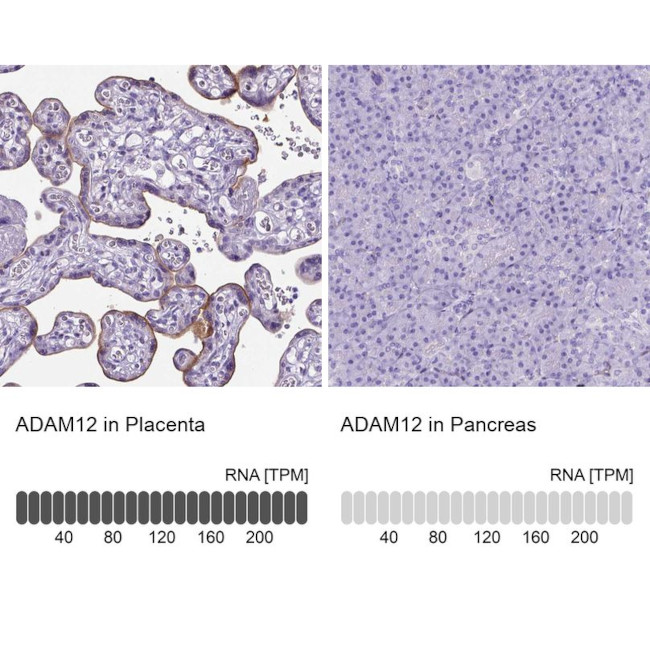 ADAM12 Antibody