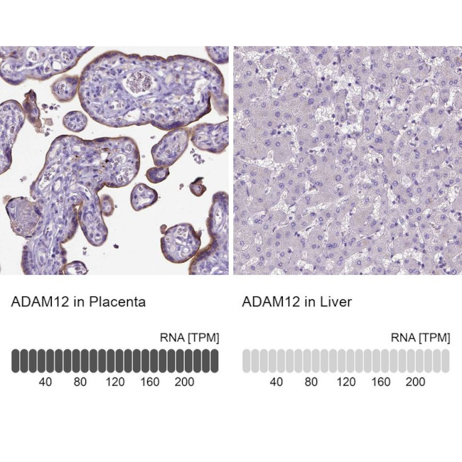 ADAM12 Antibody