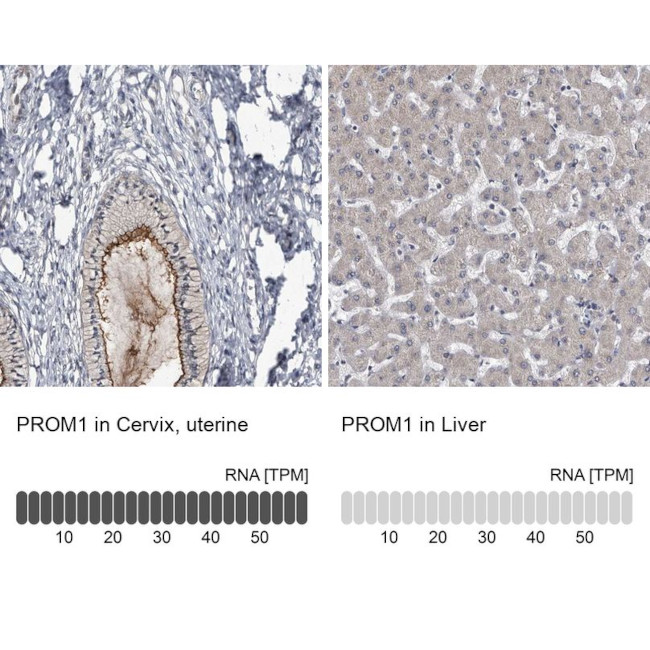 CD133 Antibody