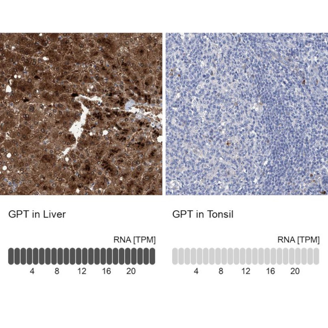 GPT Antibody