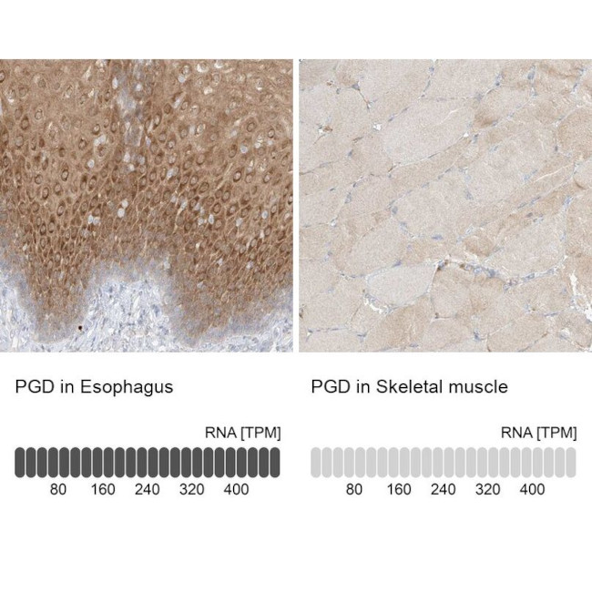 PGD Antibody