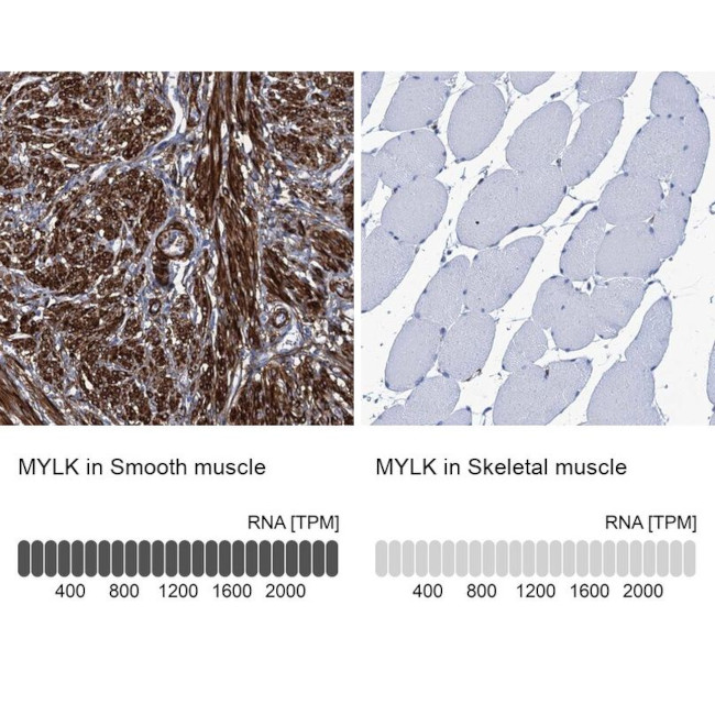 MYLK Antibody