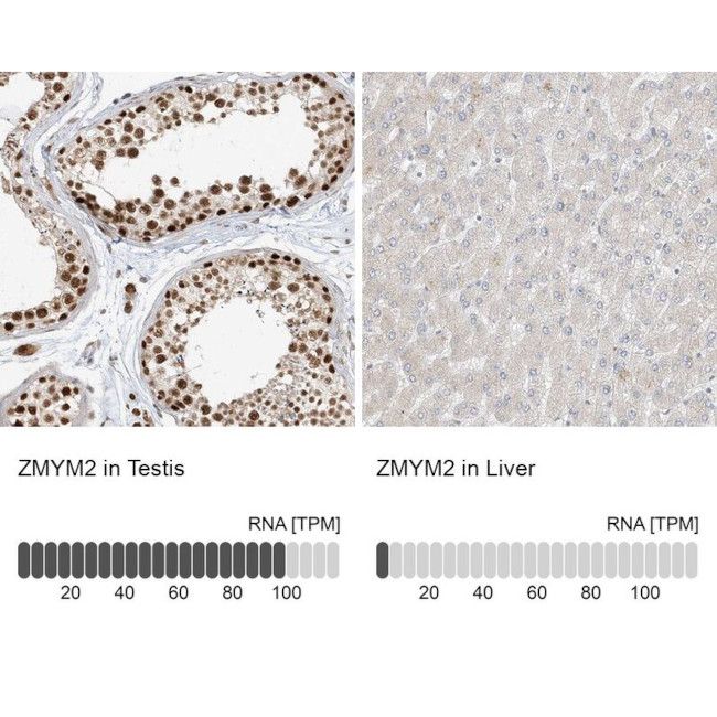 ZMYM2 Antibody