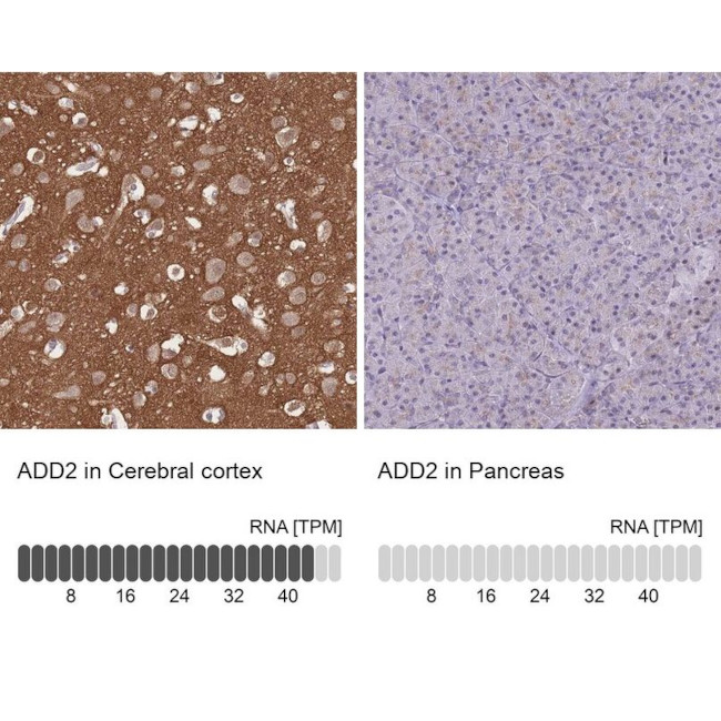 beta Adducin Antibody