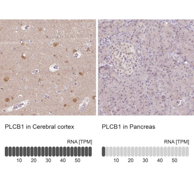 PLCB1 Antibody