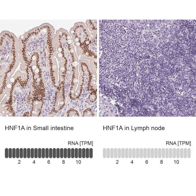 HNF1A Antibody