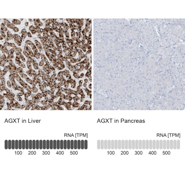 AGXT Antibody