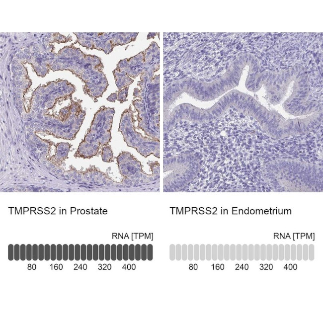 TMPRSS2 Antibody