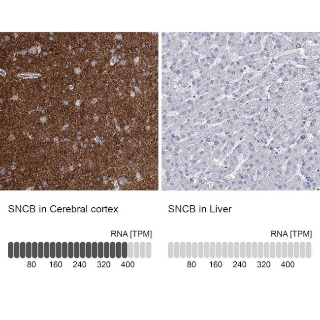 beta Synuclein Antibody