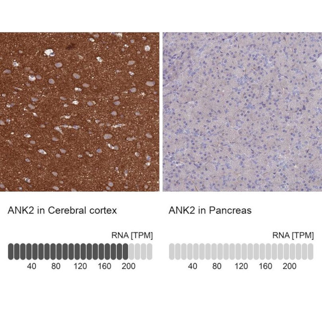 Ankyrin B Antibody