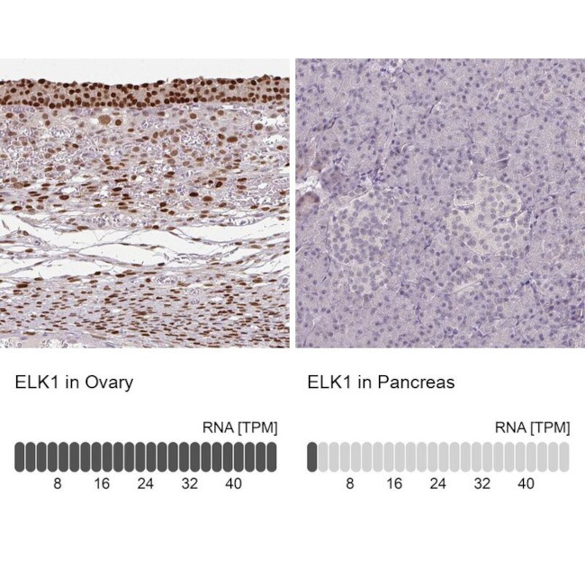 ELK1 Antibody