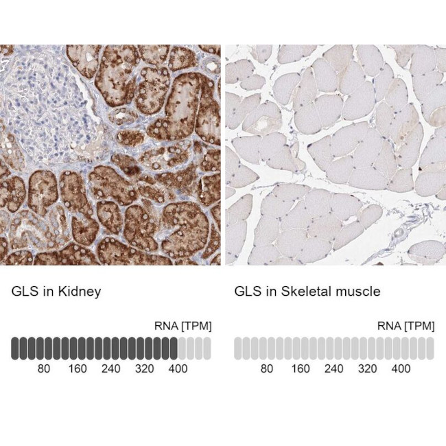 Glutaminase Antibody