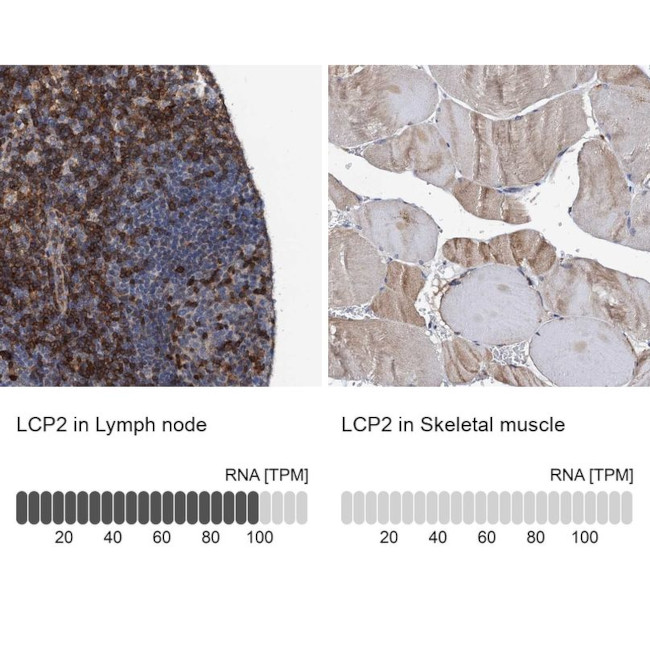 SLP76 Antibody