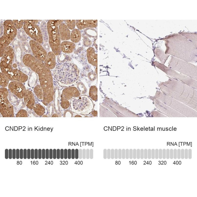 CNDP2 Antibody