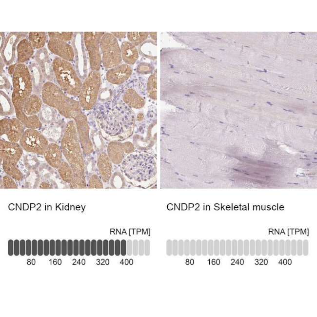 CNDP2 Antibody