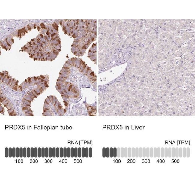 PRDX5 Antibody