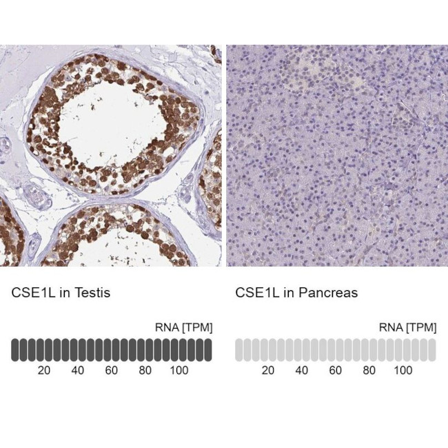 CAS Antibody