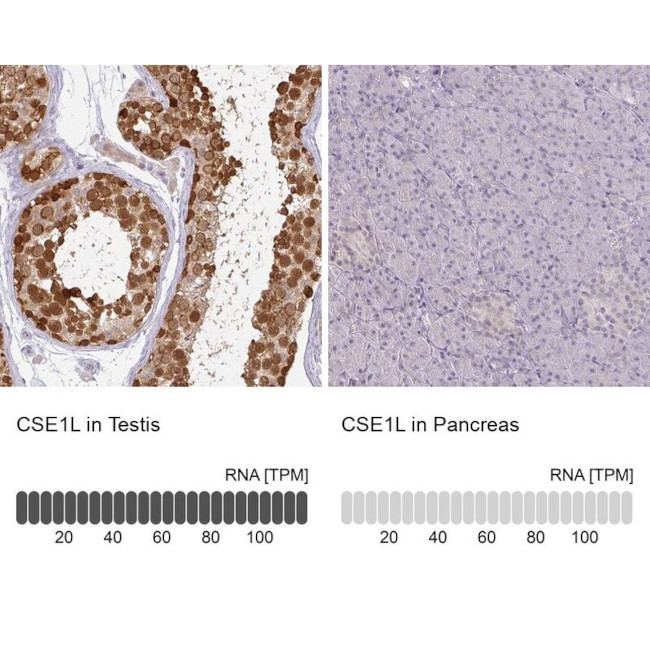 CAS Antibody