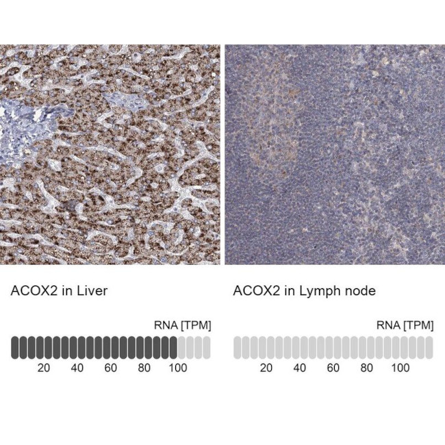 ACOX2 Antibody