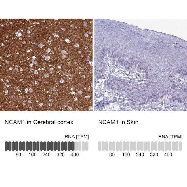 CD56 Antibody