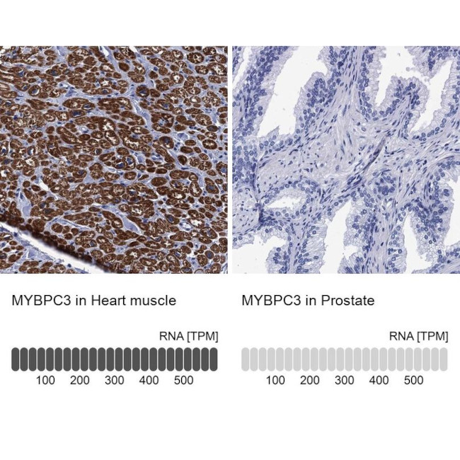 MYBPC3 Antibody