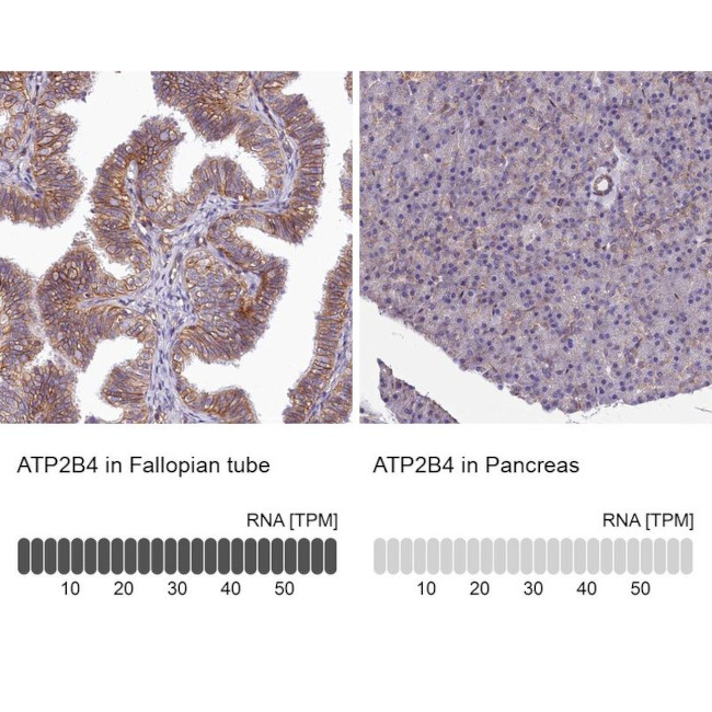 PMCA4 ATPase Antibody