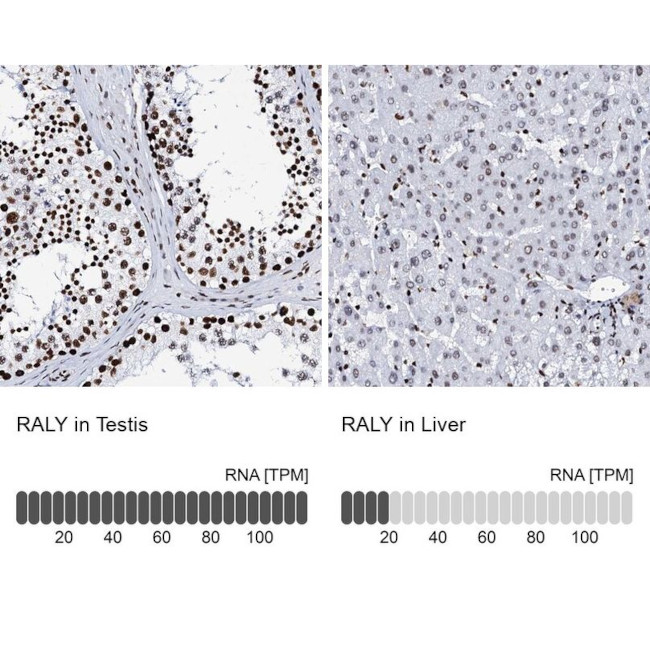 RALY Antibody