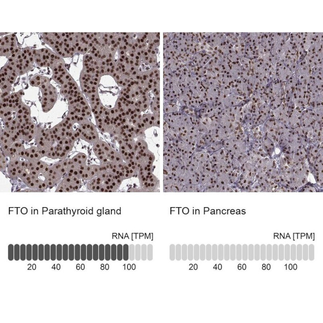 FTO Antibody