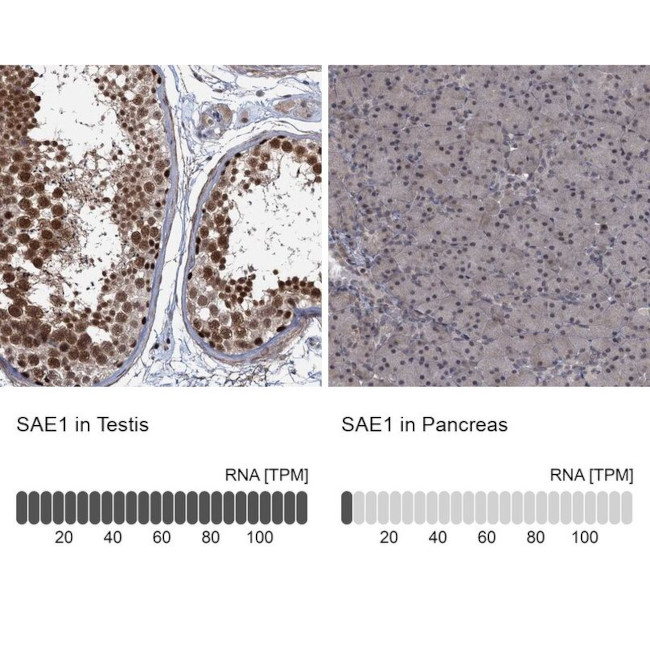 SAE1 Antibody