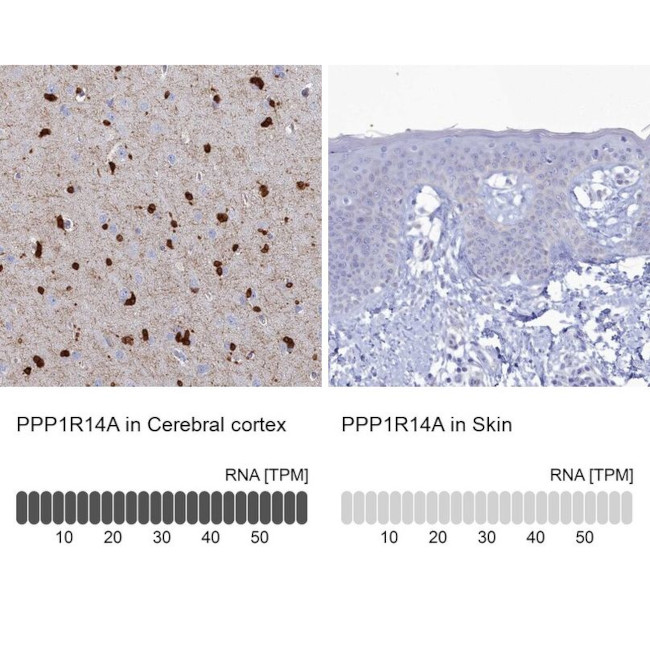 CPI-17 Antibody