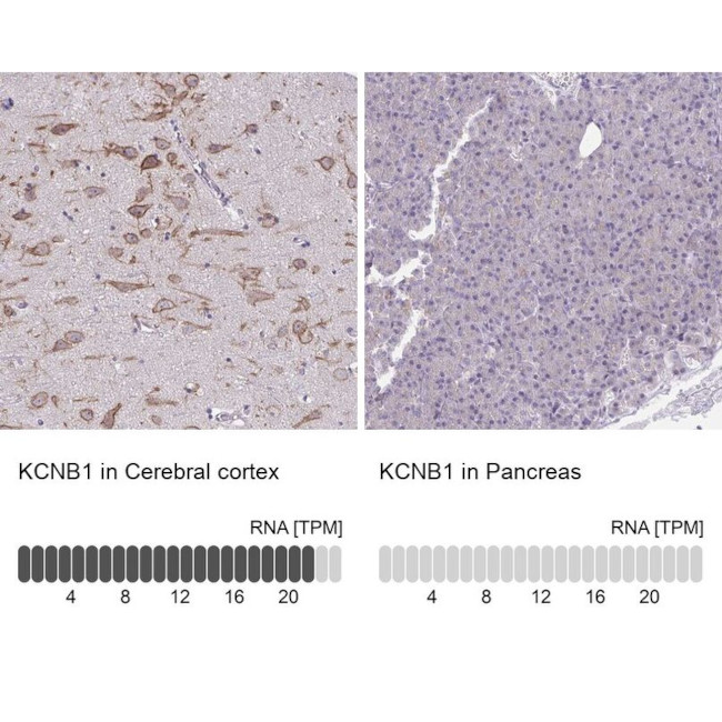 KV2.1 (KCNB1) Antibody