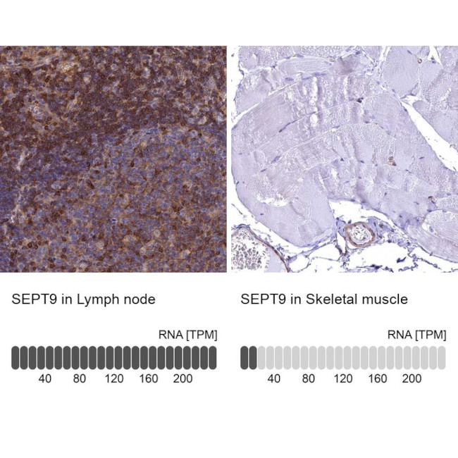 Septin-9 Antibody