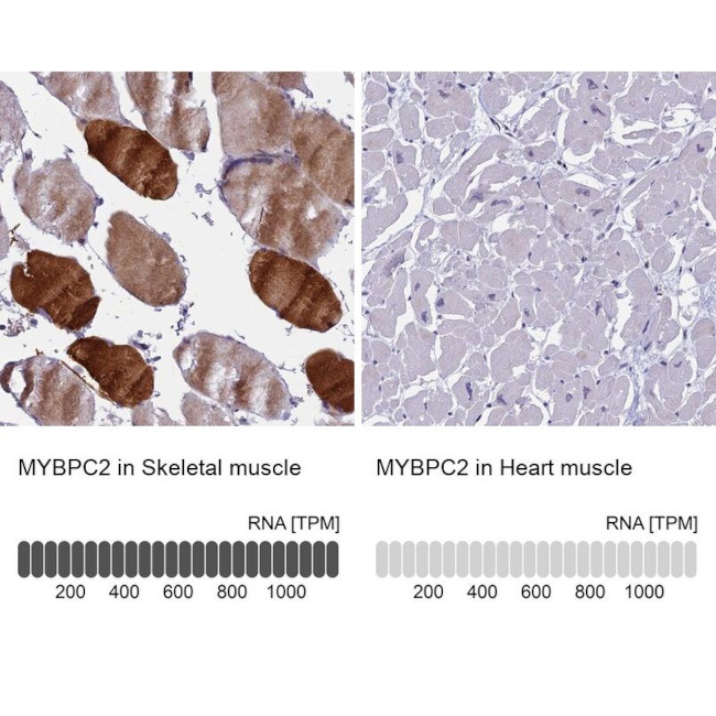 MYBPC2 Antibody