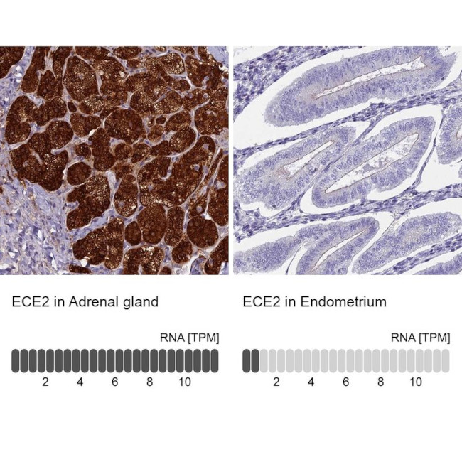 ECE2 Antibody