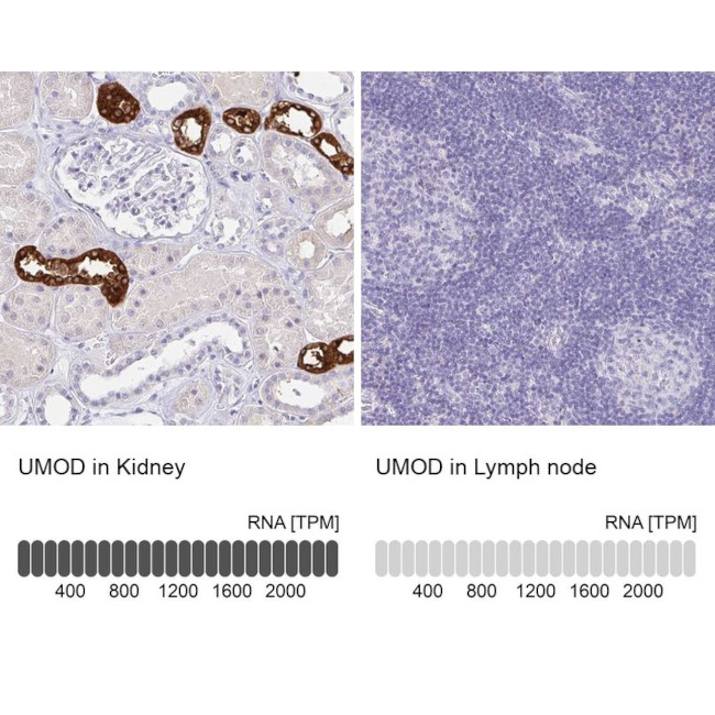 Uromodulin Antibody