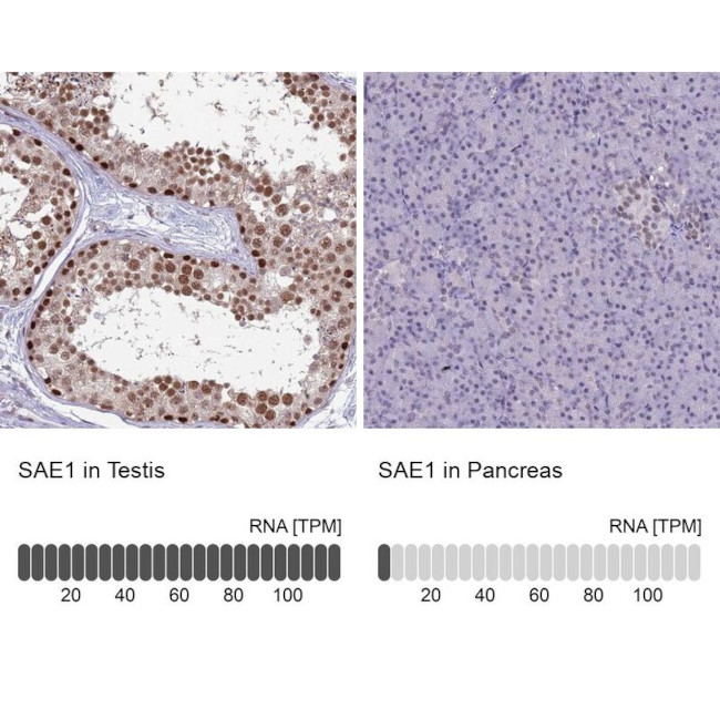 SAE1 Antibody