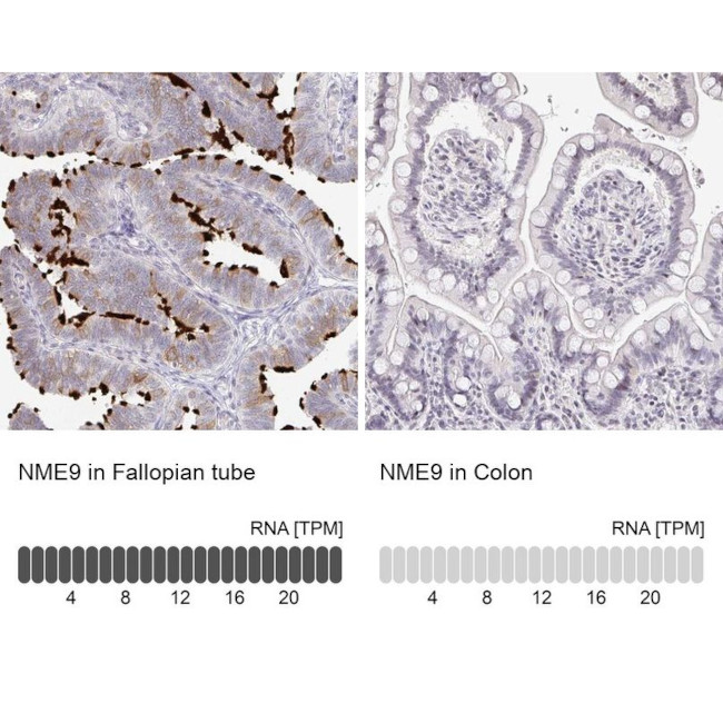 TXNDC6 Antibody