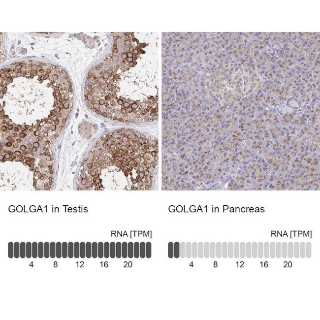 Golgin-97 Antibody