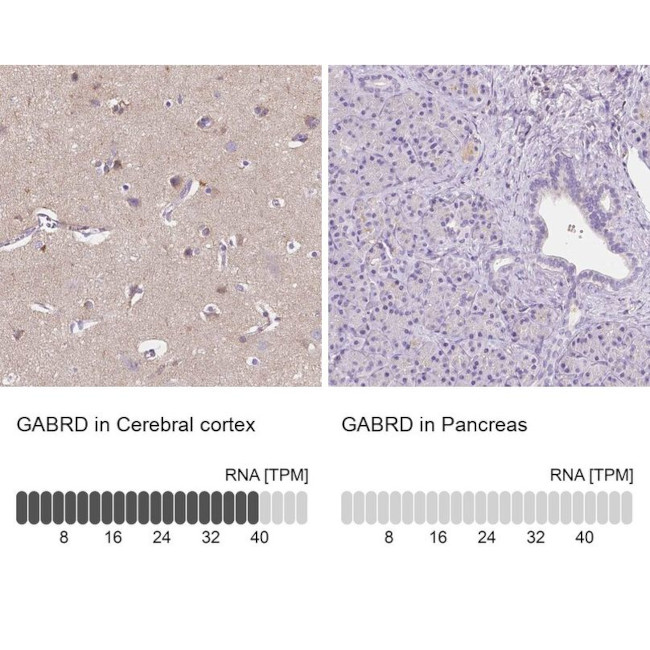 GABRD Antibody