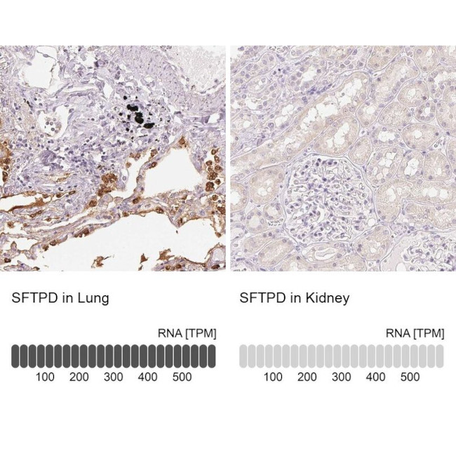 SFTPD Antibody