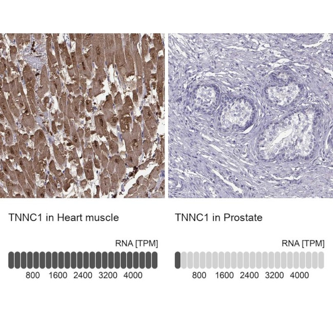 Cardiac Troponin C Antibody