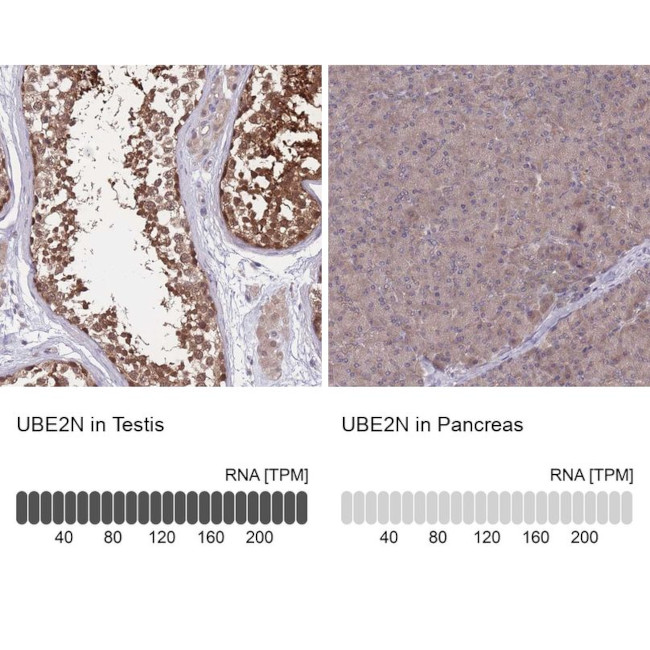 UBC13 Antibody