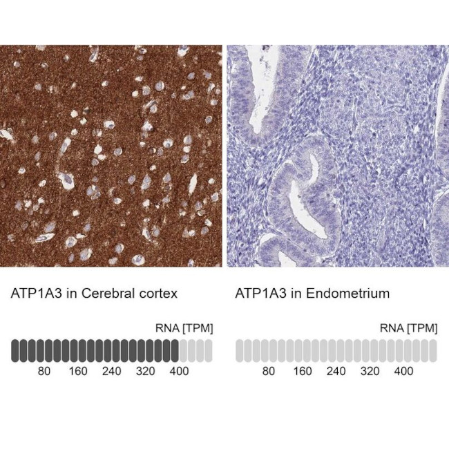 ATP1A3 Antibody