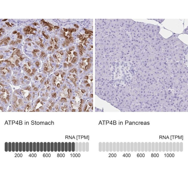 ATP4B Antibody